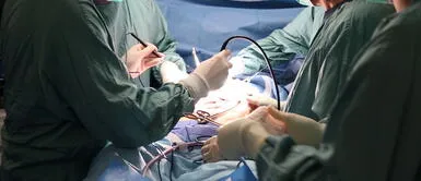 Médicos del hospital Rebagliati. Médicos peruanos logran destruir un tumor de páncreas "inoperable" con técnica nunca antes vista