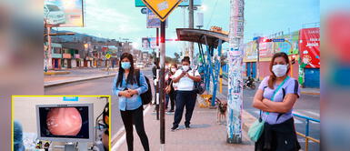 Los cálculos biliares se deben tratar oportunamente para evitar males severos Mujeres mayores de 30 años son más propensas de sufrir de cálculos a la vesícula, alerta EsSalud