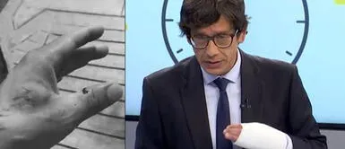 A pesar del incidente, Jaime Chincha apareció en su programa en RPP. Jaime Chincha denunció que perro pitbull lo atacó hasta dejarle una grave herida en la mano