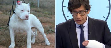 Pit Bull que mordió a Jaime Chincha en Surco debió de usar bozal y correa, según norma Pit Bull que mordió a Jaime Chincha en Surco debió de usar bozal y correa, según norma