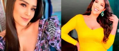 Karen Schwarz compartió con sus fans un reflexivo mensaje. Karen Schwarz muestra orgullosa sus estrías: “Soy yo, con celulitis y cicatrices. Eres más que una foto"