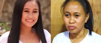 Joven de 16 años se ve como una de 50 debido a raro trastorno Joven de 16 años aparenta ser de 50 por un extraño trastorno genético