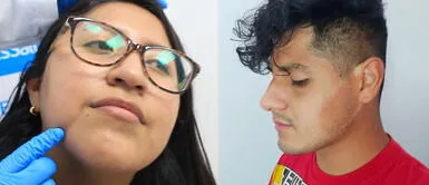 Dermatóloga enseña cómo ventilar el rostro tras el uso de mascarillas. ¿Cómo evitar infecciones a la piel por uso continuo de mascarillas?