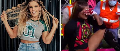 Alejandra Baigorria es operada de emergencia tras sufrir lesión en “Esto es Guerra” Alejandra Baigorria es operada de emergencia tras sufrir lesión en “Esto es Guerra”