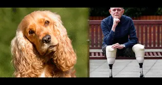 Jaco Nel presentó una septicemia debido a la saliva del perrito. Doctor pierde las piernas y la nariz por lamidas de su perro | VIDEO