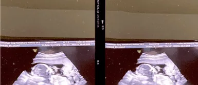 Pareja demanda a clínica de fertilidad tras dar a luz a bebé ‘equivocado’ Pareja demanda a clínica de fertilidad por intercambiar a su hija