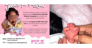 Victoria es una bebé de cuatro meses que necesita ayuda de todos para operarse Madre necesita 30 mil soles para operar a su bebé: “Soy mamá soltera y vivo con sueldo mínimo”