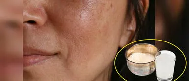 Conoce los beneficios del arroz para la salud. ¿El agua de arroz verdaderamente elimina las manchas de la cara?