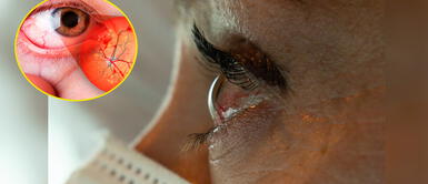 Médico Arana brinda importante advertencia a personas con comorbilidades. Problemas en la retina podrían ser primeros síntomas de la COVID-19