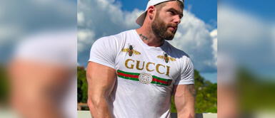 Greg Michel: piden donación de sangre para modelo y especialistas evalúan reconstrucción de su mano Greg Michel: piden donación de sangre para modelo y especialistas evalúan reconstrucción de su mano