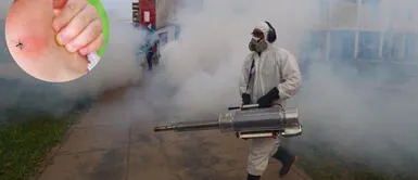 El dengue es una enfermedad infecciosa que se caracteriza su aparición en el verano. Síntomas del dengue: ¿Qué es y cómo identificar la enfermedad?