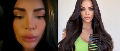 Sheyla Rojas se somete a nuevo retoque Sheyla Rojas se somete a una nueva cirugía al rostro: "Estoy inflamada"