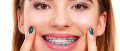 Soñar con brackets puede tener diversas interpretaciones relacionadas a las decisiones diarias. ¿Sabes qué significa soñar que se te caen los brackets?