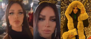 Sheyla Rojas ya no tiene líneas de expresión tras tratamiento estético. Sheyla Rojas no hace caso a la gente que la critica por sus ‘retoquitos’