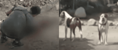 Mujer atacada por pitbulls Mujer atacada por pitbulls