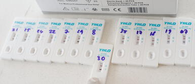 La variante del COVID-19 es predominante en Lima Metropolitana. Ómicron predomina con el 90% de casos confirmados por COVID-19 en Lima