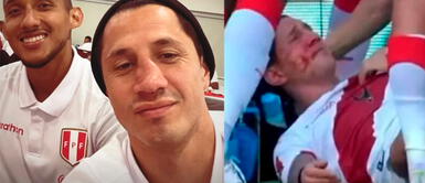 Gianluca Lapadula juega como delantero en el Benevento Calcio, Italia. Gianluca Lapadula, el jugador que siempre termina golpeado por dar todo con la 'Bicolor'