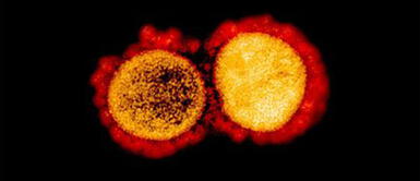 El sublinaje de Ómicron está en más de 50 países, según la OMS. Virólogos japoneses revelan que BA.2 podría ser más agresiva que Ómicron