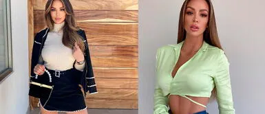 Sheyla Rojas es amante de las cirugías plásticas Sheyla Rojas: médico revela que 'botox estaría causando daño' a la modelo | VIDEO