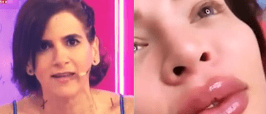 Gigi Mitre a Sheyla tras sufrir parálisis facial: Gigi Mitre a Sheyla tras sufrir parálisis facial: