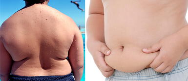 Menores de edad son propensos a padecer diabetes, alerta nutricionista. Una de cada 4 personas mayores de 15 años sufre obesidad en el país