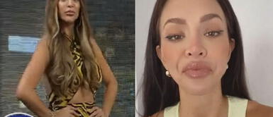 Sheyla Rojas explica en el Sketch de JB sobre el notable cambio en su rostro. Sheyla Rojas habla acerca de su parálisis facial: “no es por operación del labio, es por la de la papada”
