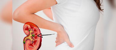 Descubre cómo cuidar tus riñones. ¿Qué funciones cumplen los riñones en el organismo? Sigue estos consejos para una buena salud