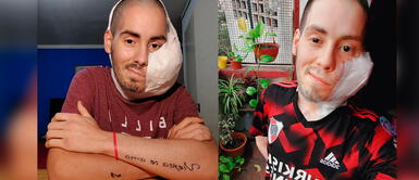 Sebastián Amurín perdió la vida a los 25 años de edad en Argentina. Falleció Sebastián Amurín, el influencer que tenía un tumor en su rostro