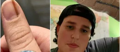 Joven queda devastada tras descubrir lo que en realidad significa la mancha en la uña que tiene hace 10 años. Joven queda devastada tras descubrir lo que en realidad significa la mancha en la uña que tiene hace 10 años