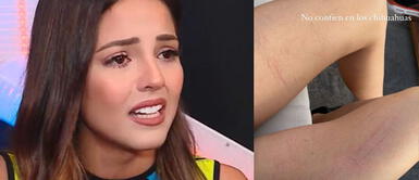 Luciana Fuster recibe arañones de los perros de Patricio Luciana Fuster fue 'atacada' por los perritos de Patricio Parodi en su casa