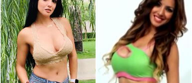 Rosángela Espinoza comentó sobre su pasado Rosángela Espinoza al ver su una foto suya antes de operaciones: “Lo más bonito es verse natural”