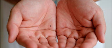 Quiromancia: significado de tener lunares en la palma de la mano esoterismo ¿Qué significa que tener lunares en la palma de mi mano?