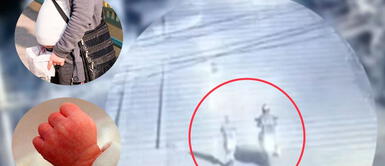 Los delincuentes se ganaron la confianza de la embarazada para luego arrebatarle del vientre a su bebé. Colombia: Mafia asesina a embarazada en situación de calle para robarle al bebé de su vientre