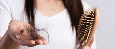 caída del cabello Conoce más sobre la mesoterapia capilar, tratamiento que ayuda a detener la caída del cabello