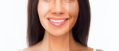 Regresa tu tono natural de piel Los 5 pasos que debes seguir para regresar a tu tono natural de piel