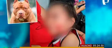 La familia de la menor denunció el hecho en la comisaría de Hualmay, en Huacho Huacho: niña, de dos años, es desfigurada por pitbull salvaje | VIDEO