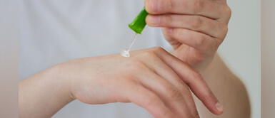 Remedios caseros para las quemaduras Remedios caseros para las quemaduras