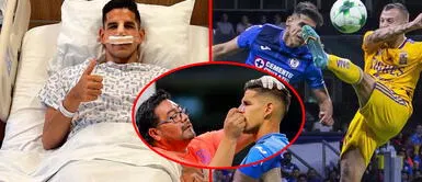 Luis Abram es considerado una de las figuras del Cruz Azul Luis Abram arriesgó su vida y casi pierde la nariz | VIDEO