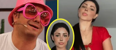 Metiche se burla de la 'nueva' nariz de Pamela Franco: Metiche se burla de la 'nueva' nariz de Pamela Franco: