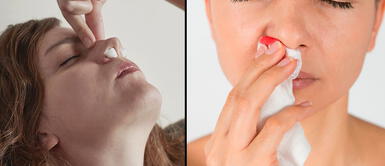 Hay que tener cuidado al momento de sonarse la nariz Sangre en la nariz: conozca las razones y cómo reaccionar