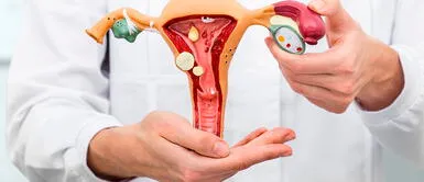 Luego de la intervención quirúrgica, es recomendable el uso de una faja para evitar complicaciones ¿Qué es la histerectomía y por qué las mujeres le tienen miedo?