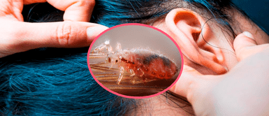 Niña muere infestada de piojos: la madre y abuela son acusadas de asesinato Niña de 9 años muere infestada de piojos: la madre y abuela son acusadas de asesinato