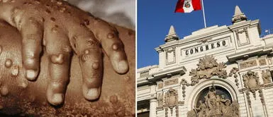 Juliaca: emprendedor peruano quita asientos de bus y lo convierte en restaurante al paso Viruela del mono: Congreso de la República confirma caso de un trabajador