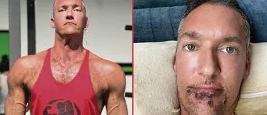 El actor porno Silver Steele está pasando duros días por la viruela del mono Actor de cine para adultos y su martirio por la viruela del mono: "No se lo deseo a nadie"