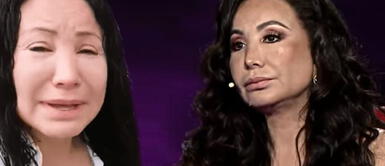 Janet Barboza es analizada por cirujano plástico y asegura que su cara tiene biopolímero Janet Barboza: médico analiza el antes y después de la 'Rulitos'