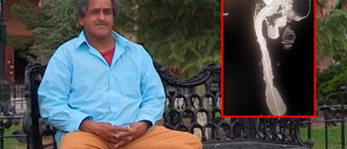 Roberto Esquivel no disfruta tener el pene más largo del mundo ¿Qué pasó con Roberto Esquivel, el hombre con el pene más largo del mundo?