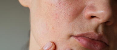 CREMAS PARA PIEL ¿Piel sensible o con rosácea? 5 cremas hidratantes que son una maravilla para tu rostro