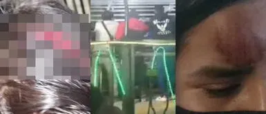 Cañete: personas resultan gravemente heridas tras desperfecto en juego mecánico Cañete: personas resultan gravemente heridas tras desperfecto en juego mecánico