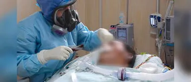 Conoce cómo prevenir el contagio por viruela del mono. ¿La viruela del mono puede causar la muerte de un paciente con comorbilidades?