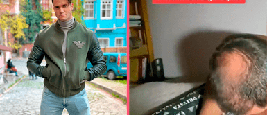 Fabio Agostini revela cuál fue el proceso que vivió al realizarse un trasplante capilar Fabio Agostini revela cuál fue el proceso que vivió al realizarse un trasplante capilar